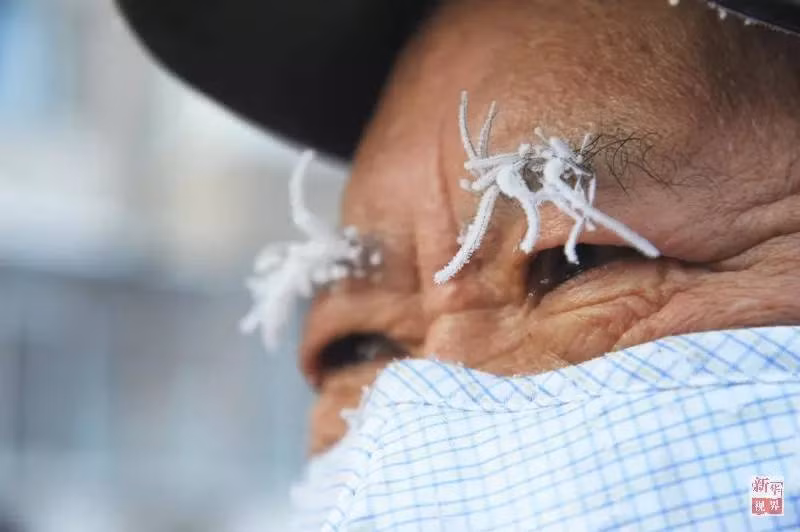 Lông mày của người đàn ông này cũng đóng băng trong cái rét ngày 21/1/2016 ở Harbin, tỉnh Heilongjiang, Trung Quốc.