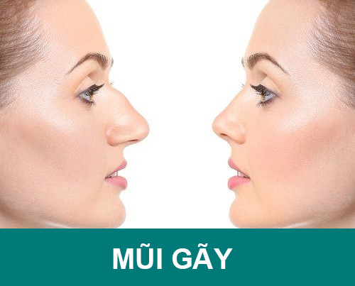 Không những thế, người này còn có nhân duyên nghèo nàn, hậu vận dễ bị con cháu bỏ rơi, bạn bè xa lánh. 