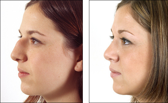 Nếu lấy chồng, cuộc sống của người này cũng không như ý, hôn nhân kém hạnh phúc, gia đình không thịnh vượng. * Thông tin mang tính chất tham khảo, chiêm nghiệm.