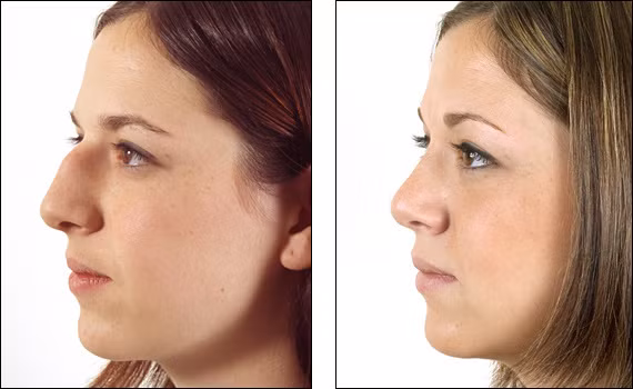 Nếu lấy chồng, cuộc sống của người này cũng không như ý, hôn nhân kém hạnh phúc, gia đình không thịnh vượng. * Thông tin mang tính chất tham khảo, chiêm nghiệm.