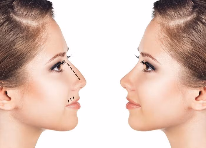 Tướng mũi gồ cho thấy số mệnh không tốt, cả tình duyên lẫn sự nghiệp đều không em đẹp. Người này còn có tính cách mệnh mẽ, cái tôi lớn, thích làm việc độc lập nên dù tài giỏi đến đâu cũng dễ sống trong cô độc, không có người tri kỷ để bầu bạn. 