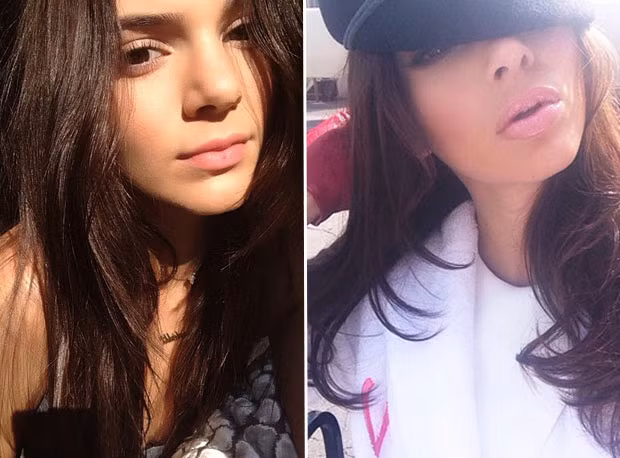 Đã nhiều lần Kendall Jenner bị so sánh đôi môi trước đây - bây giờ và dính nghi vấn bơm môi. (Ảnh: Internet)