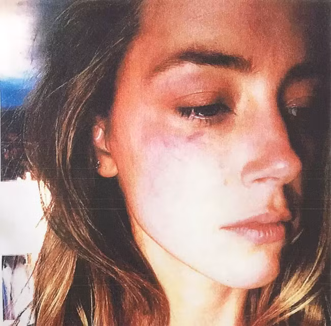 Chop khoanh khac sao Hollywood tham hai vi say ruou-Hinh-7