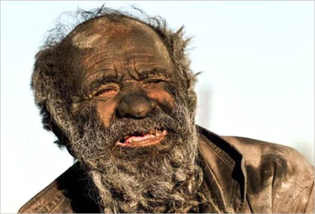 Da của cụ Amou Haji phủ một lớn cáu ghét dạy cộp, được tạo ra từ bụi bẩn và da chết, giống như cụ đang mặc “áo giáp”.