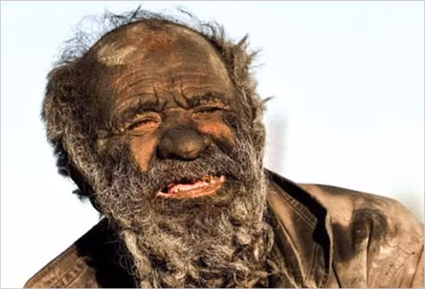 Da của cụ Amou Haji phủ một lớn cáu ghét dạy cộp, được tạo ra từ bụi bẩn và da chết, giống như cụ đang mặc “áo giáp”.