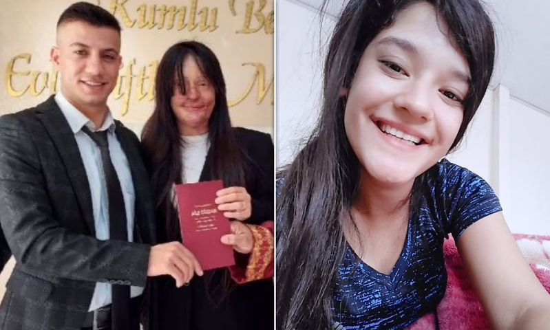 Bi ban trai tat axit bien dang mat, co gai van quyet cuoi