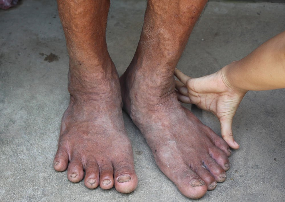 Lai lich bi an cua nguoi khong lo cao hon 2m o mien Tay-Hinh-3