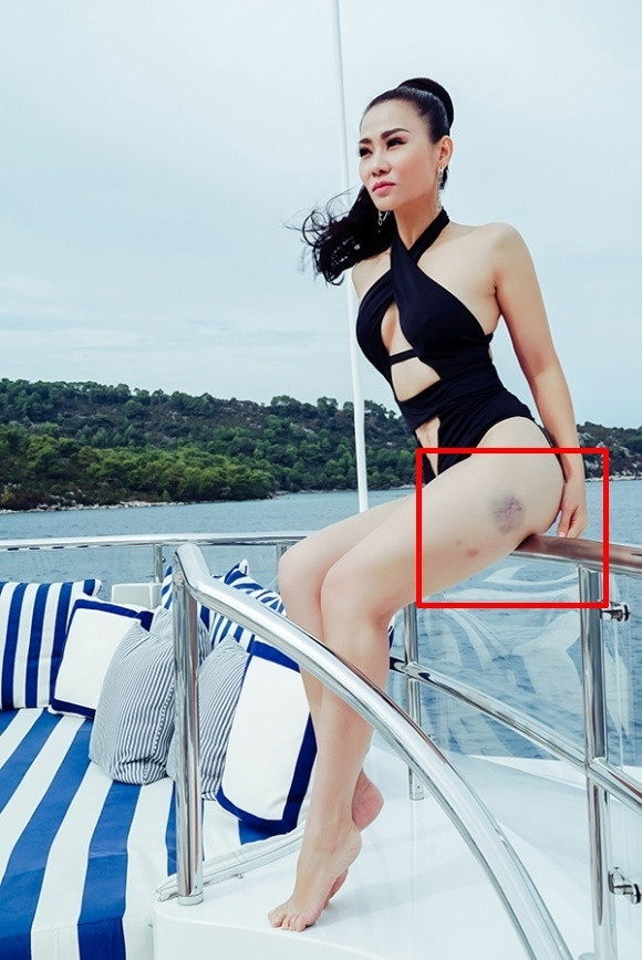 Được biết, nữ ca sĩ đã bị trượt chân ngã khi ở trên du thuyền.