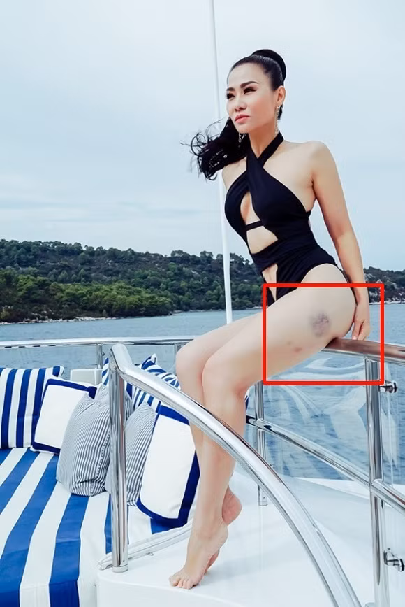 Được biết, nữ ca sĩ đã bị trượt chân ngã khi ở trên du thuyền.