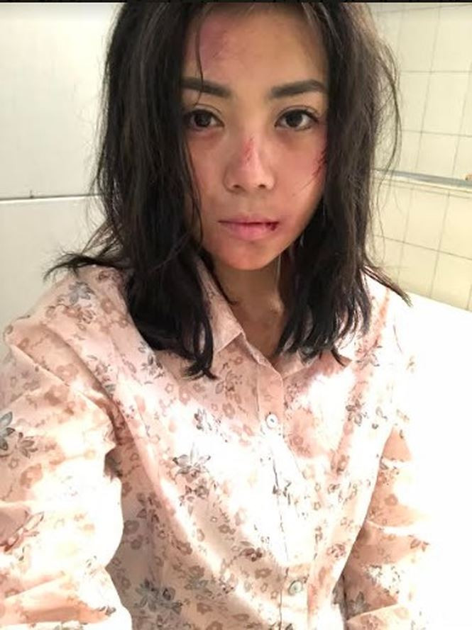 Diễn viên Thanh Hương bầm dập khi đóng vai gái mại dâm.