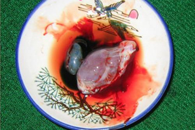 Loat mon an kinh di khong danh cho nhung nguoi yeu bong via-Hinh-2