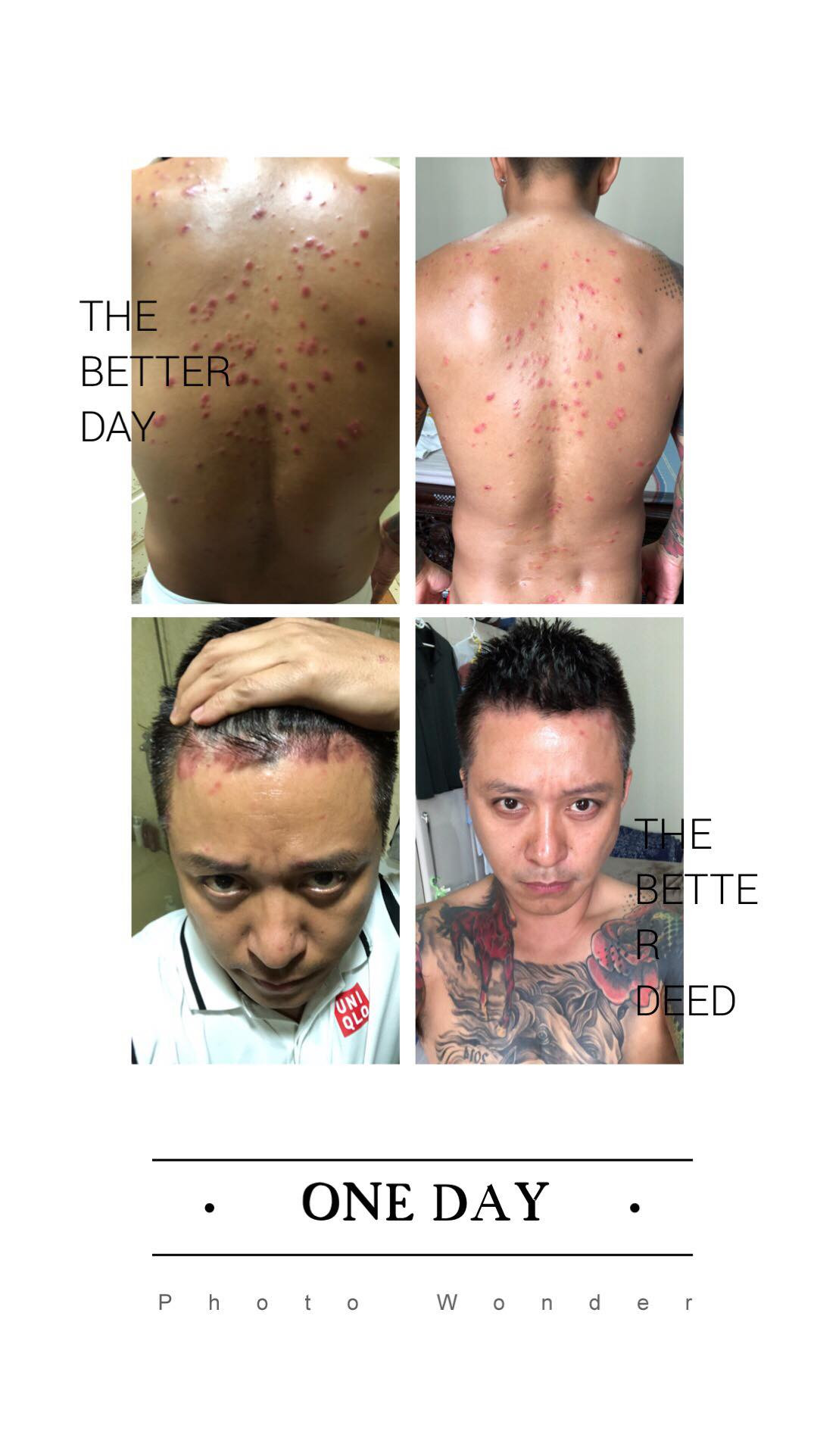 Những hình ảnh của Tuấn Hưng khi bị bệnh khiến người hâm mộ rơi nước mắt.