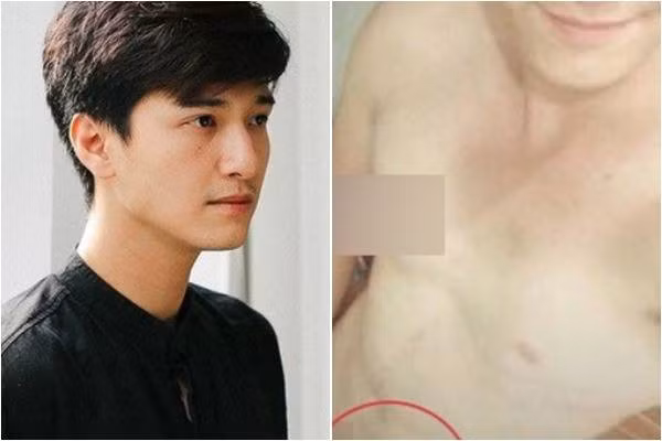 Huỳnh Anh và bức ảnh khỏa thân đang lan tràn trên mạng - được cho là của nam diễn viên.