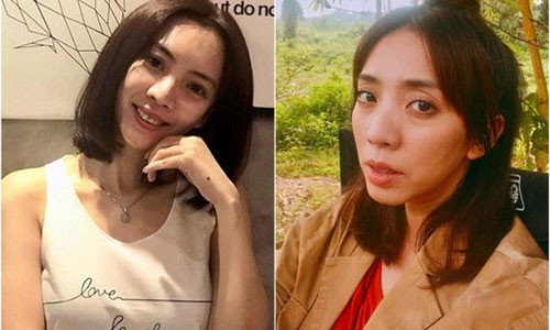 Hình ảnh Thu Trang trước và sau khi làm thủ thuật làm đẹp ở Hàn Quốc.