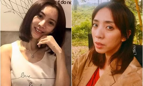 Hình ảnh Thu Trang trước và sau khi làm thủ thuật làm đẹp ở Hàn Quốc.