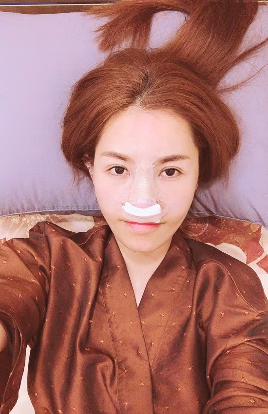 Quế Vân chi 200 triệu đồng để sang Hàn sửa mũi. Cô đang phục hồi sức khoẻ và về nước trong vài ngày tới.