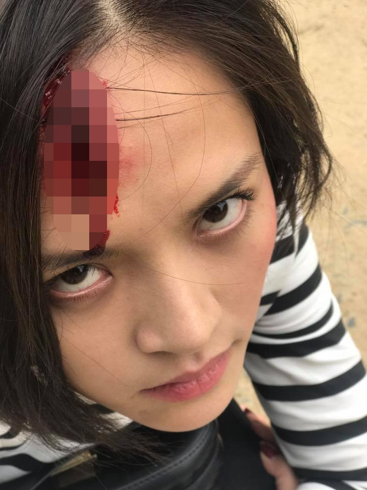 Hóa trang của nhân vật do Thu Quỳnh đảm nhận sau cảnh bị đánh đập.