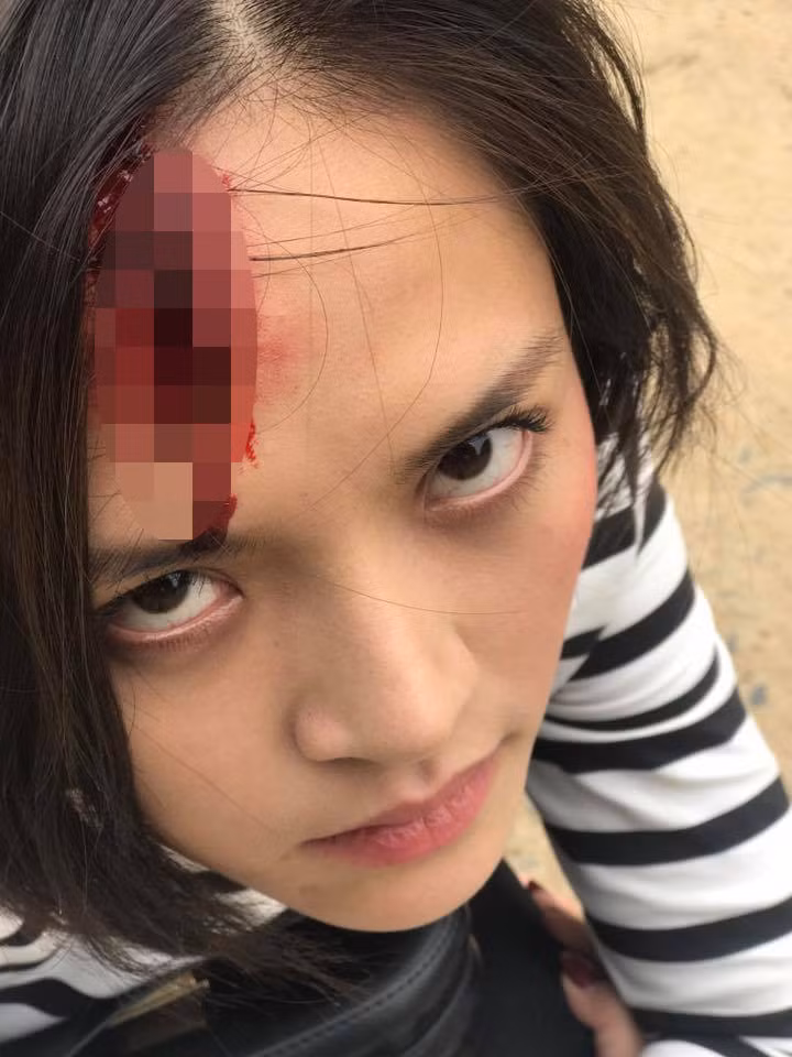 Hóa trang của nhân vật do Thu Quỳnh đảm nhận sau cảnh bị đánh đập.