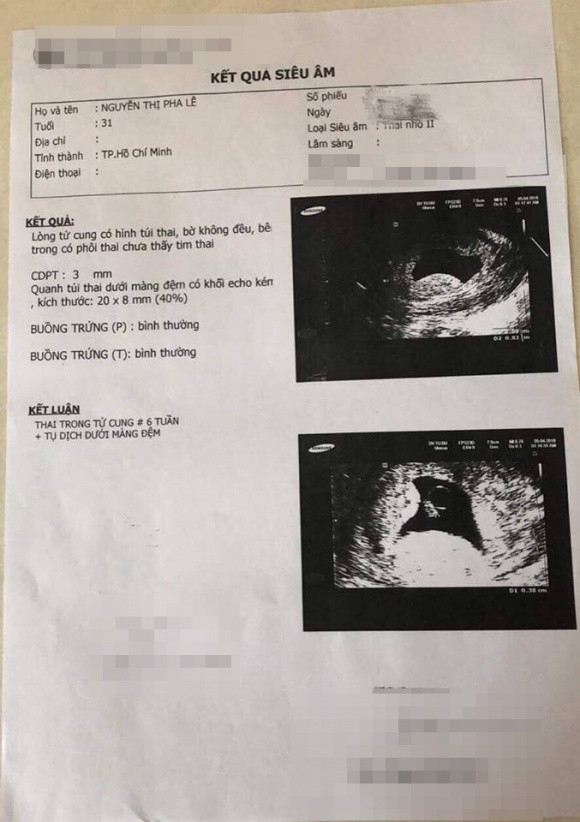 Pha Le tung co thai nhung lai bi say chi sau 1 tuan-Hinh-4