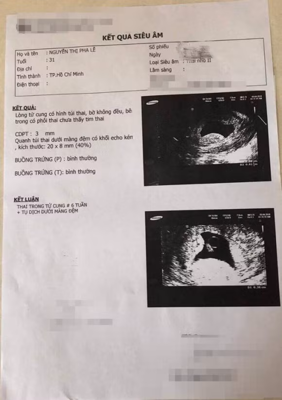 Pha Le tung co thai nhung lai bi say chi sau 1 tuan-Hinh-4