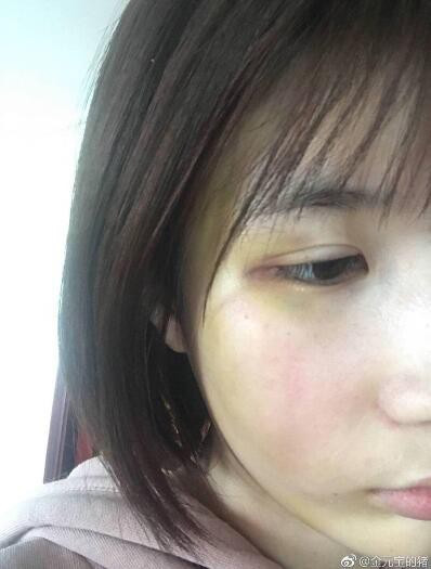 Bằng chứng bị đánh đập do Đại Kim công bố.