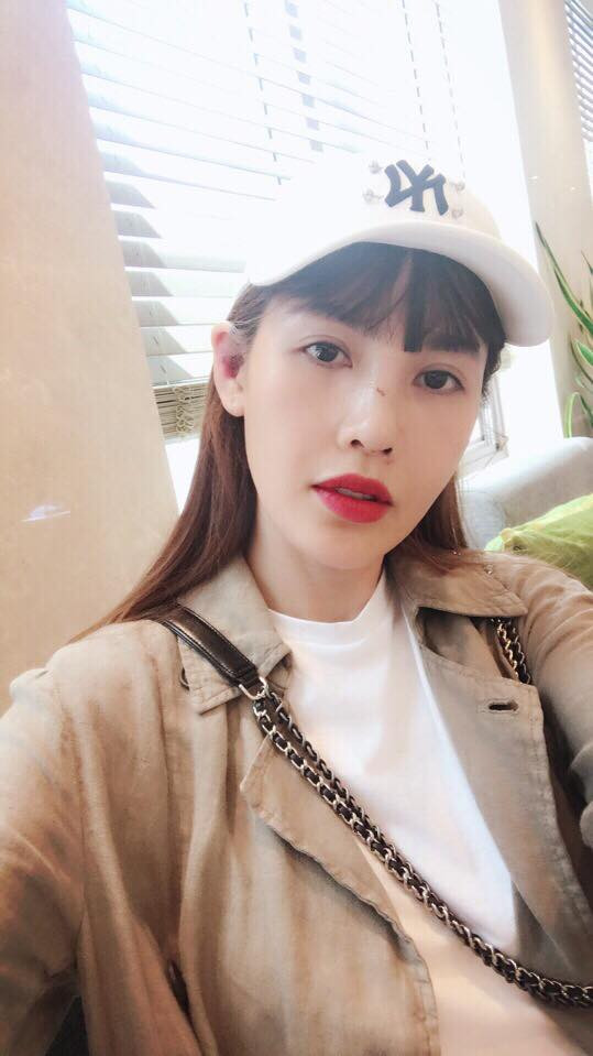 Hinh anh moi nhat cua Que Van sau dao keo lan thu 6-Hinh-2