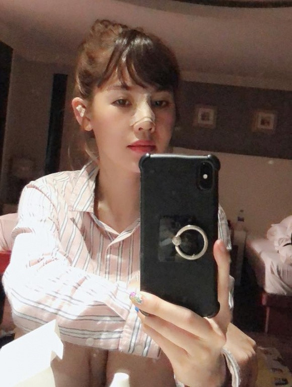 Hinh anh moi nhat cua Que Van sau dao keo lan thu 6