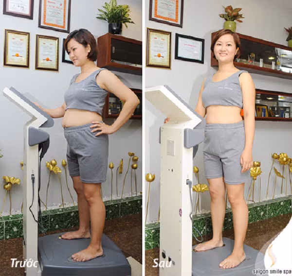 65.000 nguoi Viet giam beo theo cach nguoi Nhat-Hinh-2