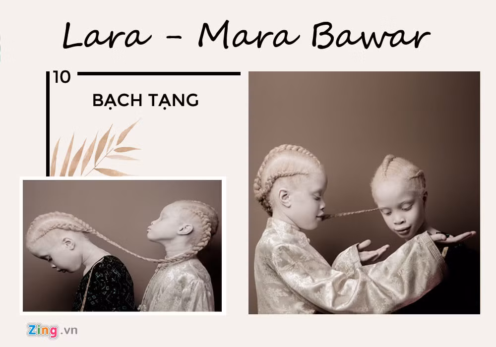 Lara - Mara Bawar bị bạch tạng bẩm sinh nên da và tóc đều trắng bệch. Song hai chị em đều rất yêu cơ thể của mình, coi việc lớn lên với bạch tạng là trải nghiệm tuyệt vời. Nhờ vẻ đẹp độc đáo, cặp song sinh từng ký hợp đồng người mẫu nhiều "ông lớn" trong ngành như Nike, Insanis và Bazaar Kids.