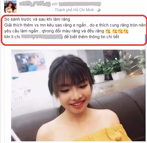 Mới đây, trên trang facebook cá nhân, bà mẹ đơn thân này tiếp tục chia sẻ loạt hình ảnh trước và sau khi sửa răng để mọi người thấy rõ được sự khác biệt. "So sánh trước và sau khi làm răng. Giải thích thêm với mọi người kêu sao răng em ngắn, do em thích cung răng tròn nên yêu cầu làm ngắn, quan trọng đổi màu răng và đều răng. Mọi người liên hệ chị... để biết thêm thông tin chi tiết" - Quách Phượng viết.