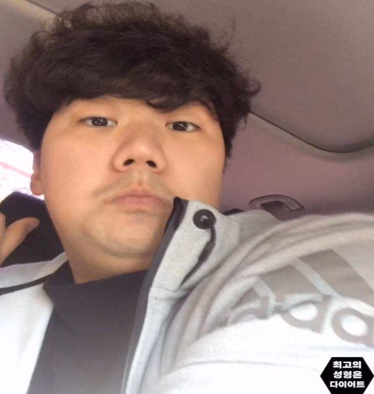 Cơ thể béo phì cộng với mái tóc xoăn rối khiến Jung Gun Chul "mất điểm" trong mắt nhiều người. Không những thế, sức khỏe của anh cũng giảm đi rõ rệt do hậu quả của việc thừa cân.