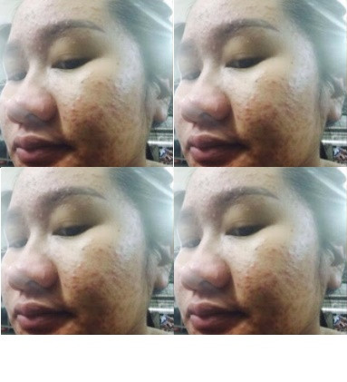 Tuy nhiên, cũng trong khoảng thời gian nhan sắc "xấu đến mức kinh khủng đó", Cẩm Nhung lại phát hiện và được đón nhận những tình cảm chân thành, cách đối xử rất tuyệt vời từ người chồng của cô. Rất nhiều người ngoài chứng kiến nhan sắc xuống cấp của Nhung đều dễ buông những lời nhận xét vô tâm, những lời chê bai khiến cô đau lòng... nhưng Tuấn Anh - chồng của cô trong suốt quãng thời gian đó đều không chê cô nửa lời, ngược lại còn rất cảm thông và cố gắng chăm sóc cho vợ thật cẩn thận.