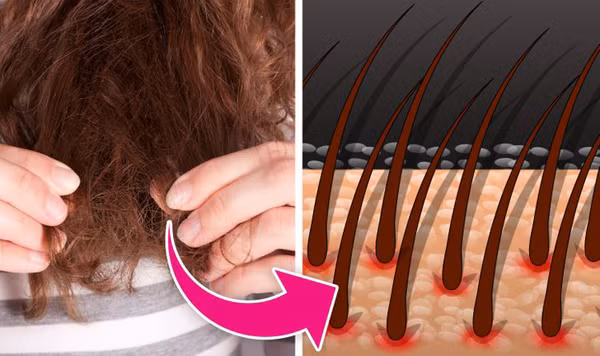 Vuốt tóc. Các hành động kéo, xoa liên tục không có lợi cho sức khỏe mái tóc. Việc tác động lực kéo liên tục khiến phần nang ngày một suy yếu. Hơn nữa, tay dù giữ sạch đến đâu thì vẫn chứa mồ hôi, bụi bẩn và điều này thì không hề tốt với tóc.
