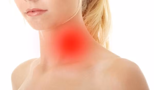 Bên cạnh nguyên nhân do viêm nhiễm vùng mũi xoang, viêm loét amidan, viêm họng, viêm tấy nướu răng, viêm tuyến nước bọt,... gây nổi hạch cổ. Một trong những nguyên nhân gây sưng hạch bạch huyết là bệnh lao. Đáng nói, hạch do lao thường nhỏ, nhiều, kích thước không đều, không đau nên rất khó phát hiện bằng quan sát thông thường.