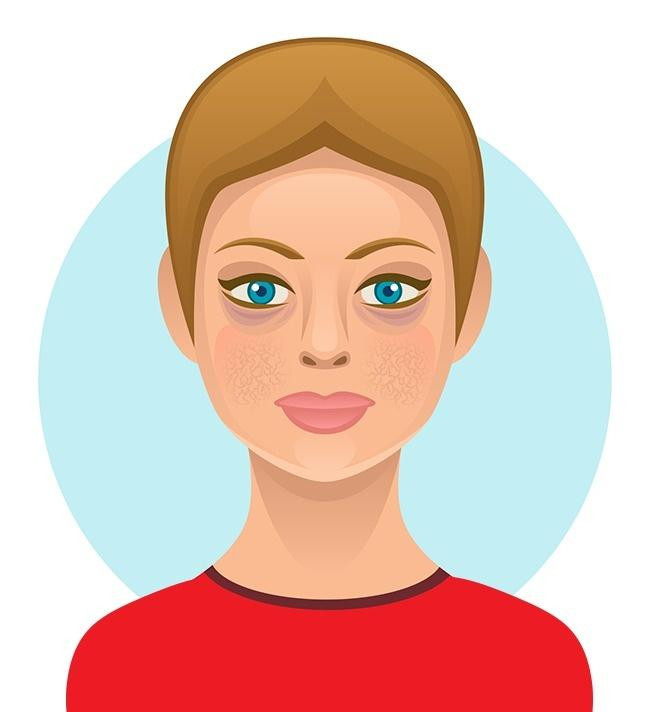 Bánh gạo có thể dẫn đến nếp nhăn trên da, thậm chí ảnh hưởng đến chức năng não. Nhưng nếu thực sự thích bánh gạo, hãy cân nhắc chọn những loại có chứa hạt lanh, thêm rau mầm, gà tây, cà chua hoặc bất kỳ loại rau yêu thích nào khác để có được chất béo không bão hòa, canxi và sắt.Ảnh Brightside