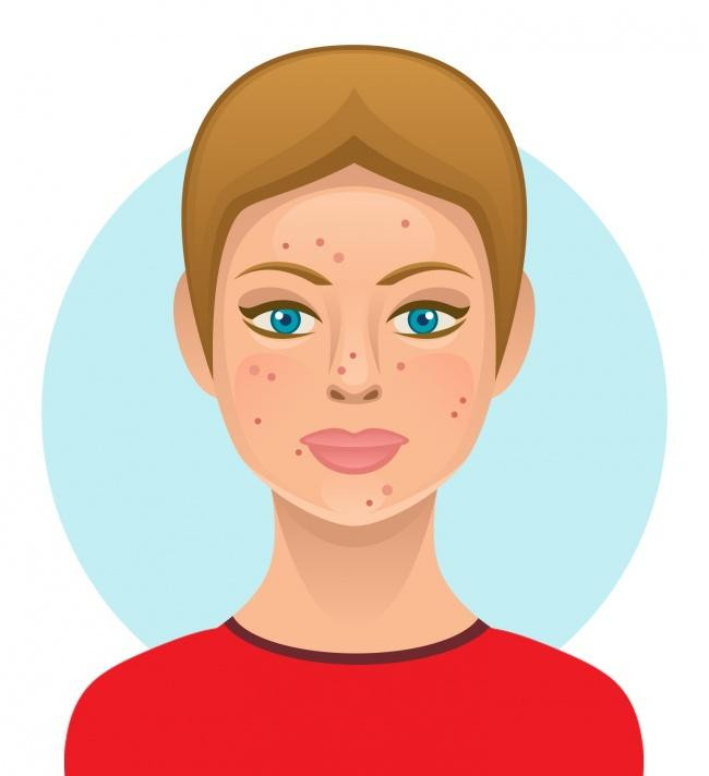 Gạo có chỉ số đường huyết cao có thể lấy đi độ ẩm lớp biểu bì, gây khô da và lão hóa sớm. Nếu ăn sushi, bạn nên uống nhiều nước, tập thể dục cho khuôn mặt, ngủ nghiêng để không cho chất lỏng tích tụ vào mặt. Ảnh Brightside