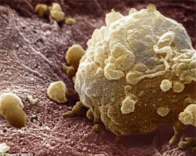 Hạt đu đủ ngăn ngừa ung thư: Các hợp chất phenolic và flavonoid trong hạt cung cấp tính chất chống oxy hóa cao giúp làm chậm sự phát triển của tế bào ung thư. Các isotiocyanate isotiocyanat thực vật trong hạt đu đủ, đặc biệt, giúp ức chế tế bào ung thư vì nó làm giảm hoạt hóa chất gây ung thư và tăng cường giải độc.