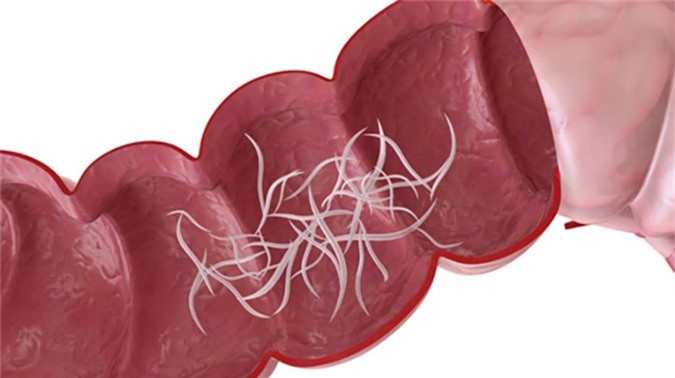 Diệt ký sinh trùng đường ruột: Enzyme proteolytic trong hạt đu đủ giúp tiêu diệt ký sinh trùng đường ruột. Enzyme này giúp phân hủy protein trong cơ thể cũng như ký sinh trùng và trứng của chúng để làm sạch ruột của bạn.
