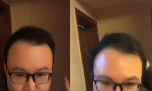 Khong goi dau bang dau, nguoi dan ong bi hoi nhan ket ky dieu