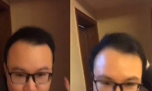 Khong goi dau bang dau, nguoi dan ong bi hoi nhan ket ky dieu