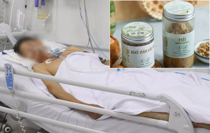 Ngo doc pate Minh Chay: Bao nhieu nguoi mua san pham?