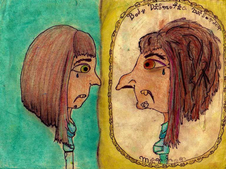 Người bị hội chứng này thường soi gương rất nhiều và luôn chăm chút ngoại hình của mình một cách thái quá. Đây có thể là lần đầu bạn nghe đến hội chứng kì lạ này, nhưng một sự thật đáng sợ là hội chứng này đã và đang ảnh hưởng đến 2,4% dân số thế giới.