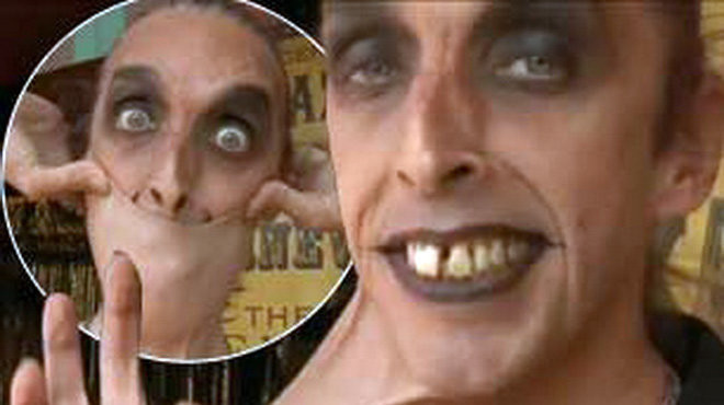 Làn da co giãn: Garry Turner đến từ Anh là người có làn da co giãn nhất thế giới với kỷ lục có thể căng da bụng tới 15,8 cm.