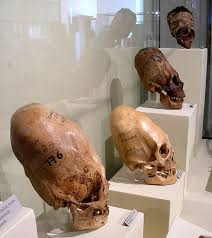 Điểm chung giữa các nền văn minh này là quá trình thực hiện kéo dài hộp sọ thường bắt đầu khi đối tượng khoảng dưới 10 tuổi.