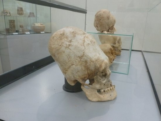 Để kéo dài hộp sọ, người xưa thường dùng hai tấm nẹp và cố định hộp sọ bằng vải quấn xung quanh. Nhờ vậy, những đứa trẻ khi trưởng thành có hộp sọ thuôn dài giống hình quả trứng mà không chịu tác động tiêu cực đến khả năng nhận thức.