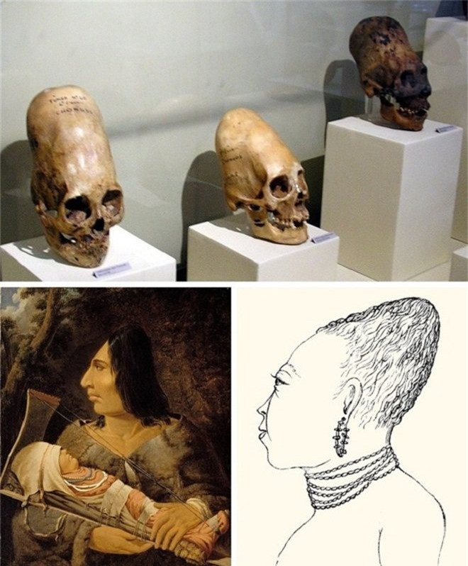 Kéo dài sọ: Tập tục kỳ lạ này xuất hiện ở rất nhiều cộng đồng người trên khắp thế giới. Mục đích của cách làm này là để tạo đặc điểm riêng cho từng cộng đồng người, hoặc thể hiện địa vị xã hội.