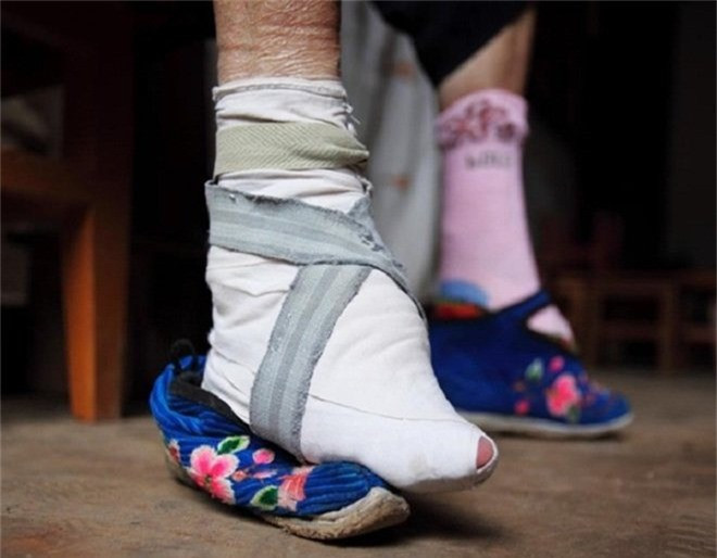 Bó chân: Chỉ khi có được đôi chân nhỏ nhắn, thon thả thì các thiếu nữ Trung Quốc mới mong lấy được chồng giàu sang. Trào lưu này thịnh hành gần 1.000 năm trước rồi bị hủy bỏ bởi tác hại lâu dài đối với sức khỏe.