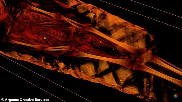 Từ đây, các chuyên gia suy đoán bé gái 5 tuổi người Ai Cập có thể chết vì bệnh tật.