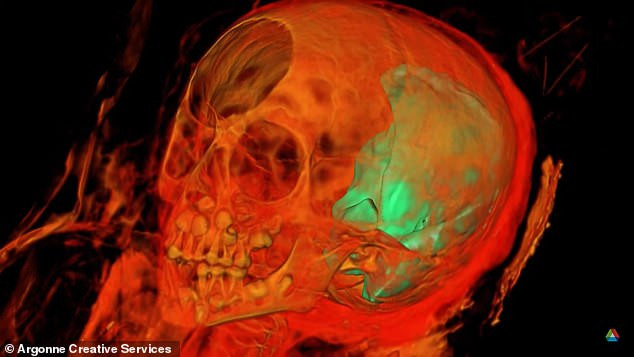 Các chuyên gia cũng phát hiện 36 vật thể giống như cây kim, 11 chiếc xung quanh đầu và cổ, 20 chiếc ở gần bàn chân và 5 chiếc ở thân của xác ướp bé gái 5 tuổi.