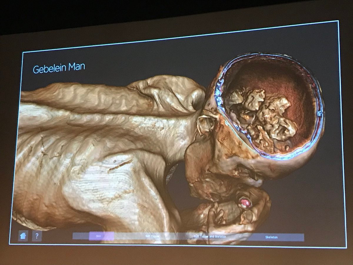 Các chuyên gia vô cùng kinh ngạc khi người đàn ông "Ginger" qua đời hơn 5.000 năm trước nhưng vẫn còn nguyên mái tóc màu vàng, móng tay và móng chân.